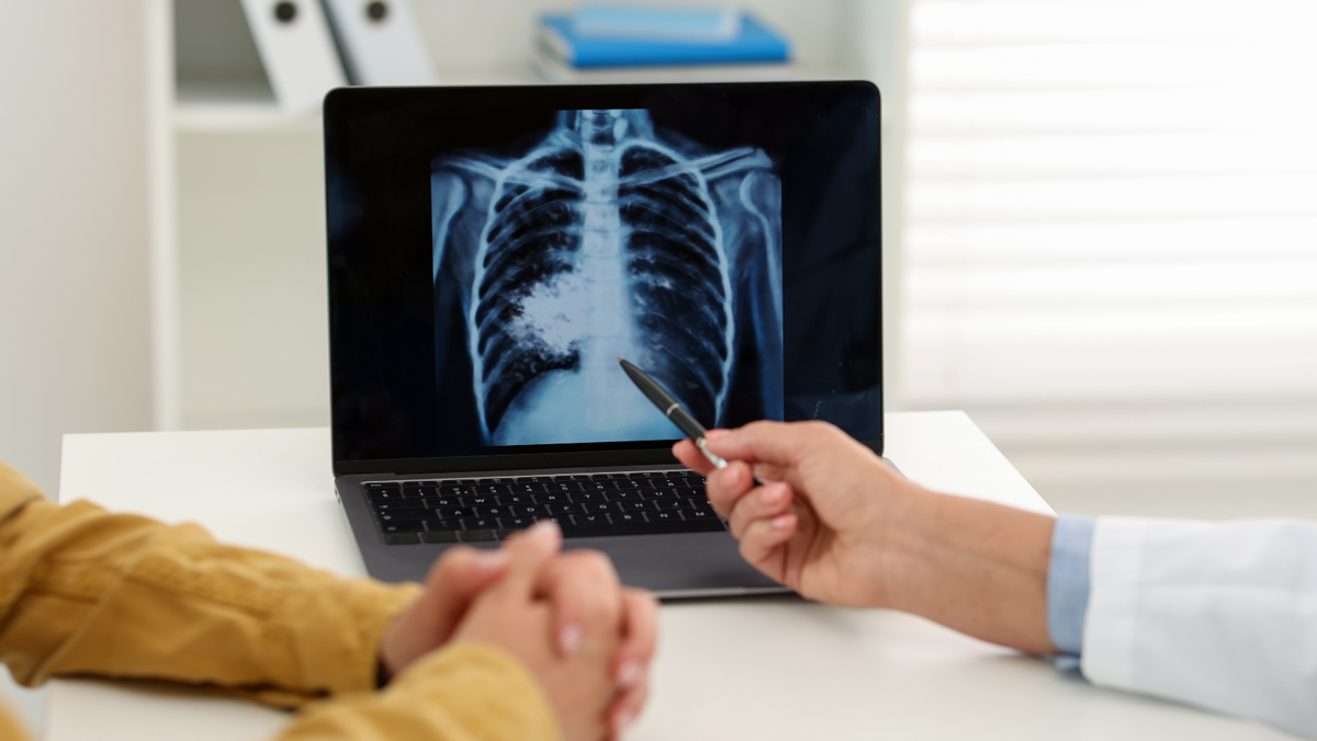 Progres în lupta cu tuberculoza: mortalitatea - în scădere, dar pacienții vulnerabili nu se tratează complet